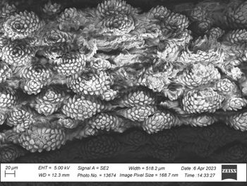 Media type: image;   Invertebrate Zoology 32029 Description: SEM image of specimen.;  Aspect: dorsal
